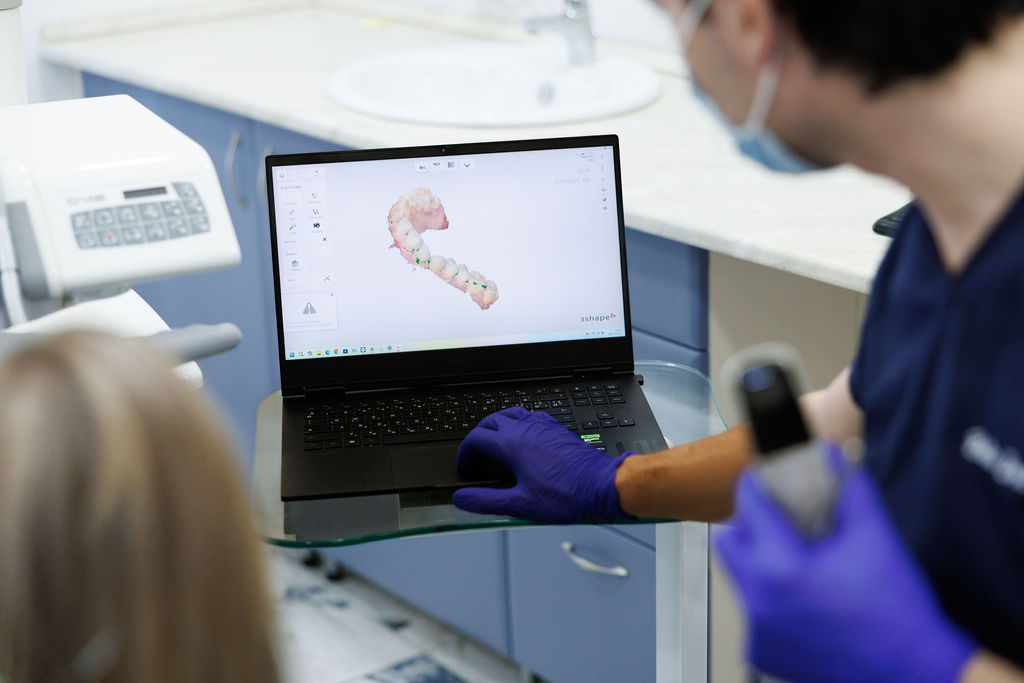 A fogászati intraorális szkenner